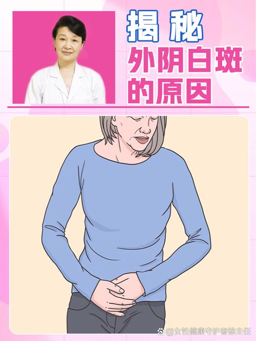 妇科白斑是什么病图片,妇科白斑是怎么形成的原因